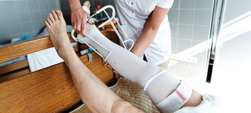 Medias de compresión para el tratamiento de las varices.