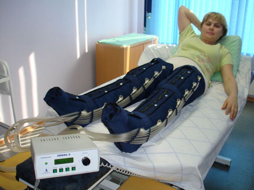 Presoterapia para el tratamiento de las varices en las piernas.